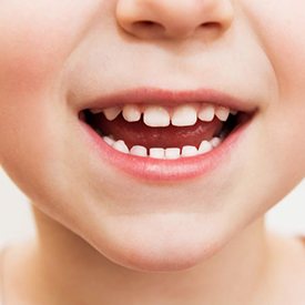 Child’s smile full of baby teeth