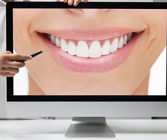 Smile preview on computer screen