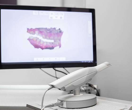 Digital smile design system on computer screen