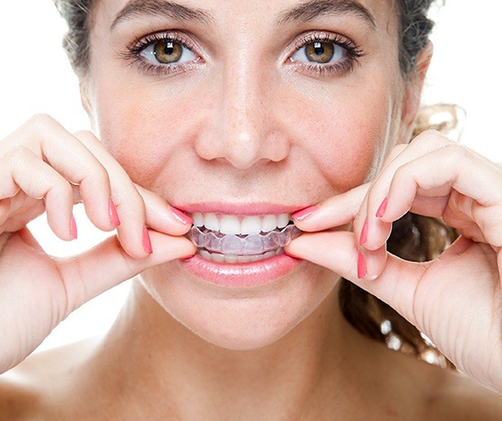 Woman placing Nu Smile Aligner tray