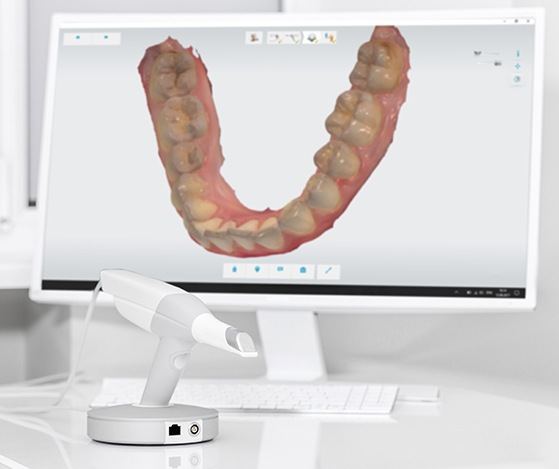 Digital smile design system on computer screen