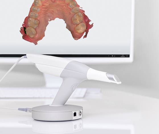 Digital smile design system on computer screen