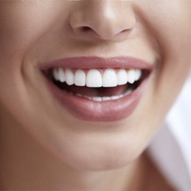 Closeup of beautiful smile after Invisalign alternative in Brick 
