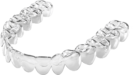 Nu Smile Aligner sample