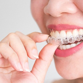 Woman placing her top Invisalign aligner in her mouth