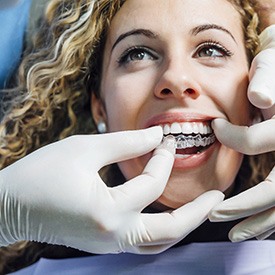 Woman visiting her dentist of Invisalign checkup in Staten Island 