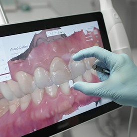 Dentist viewing digital impressions