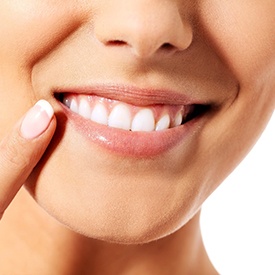 Woman pointing at her smile after successful treatment of open bite