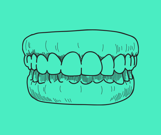 Animated smile with overbite