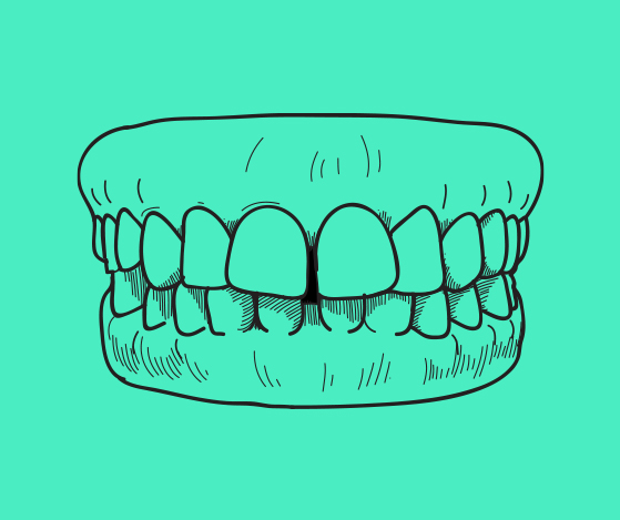 Animated smile with large gaps between teeth