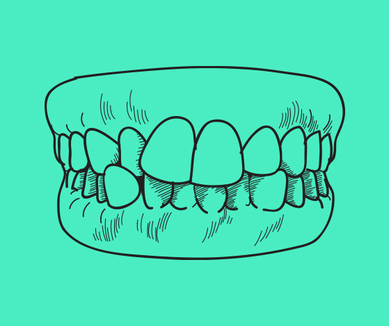 Animated smile with crooked teeth